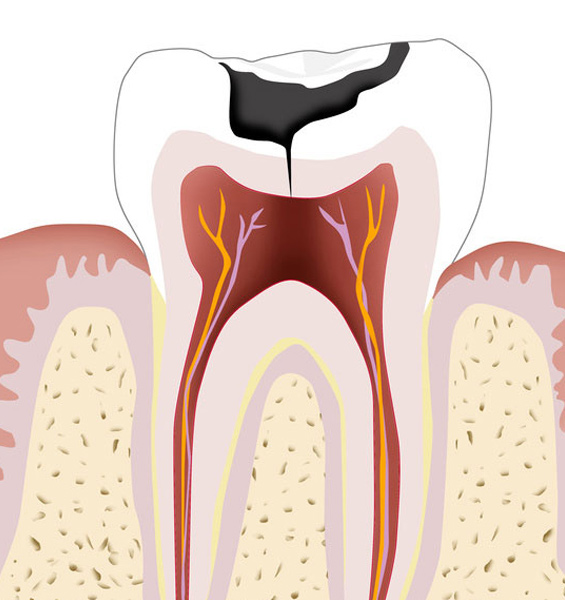 Endodontia-OK