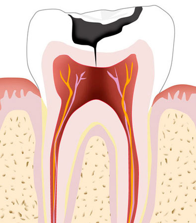 Endodontia