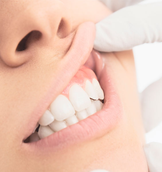 Periodontia-interna