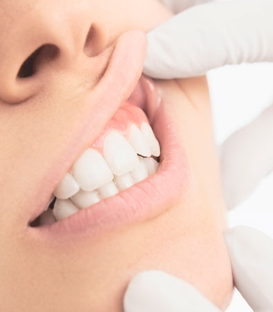 Periodontia
